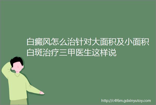 白癜风怎么治针对大面积及小面积白斑治疗三甲医生这样说